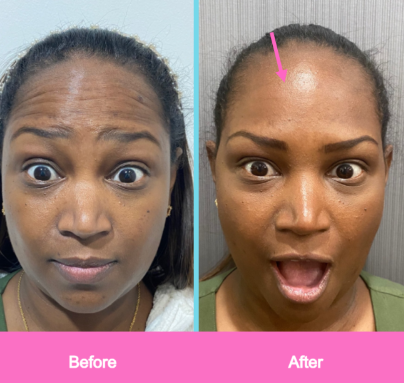Fine Face Sculptor