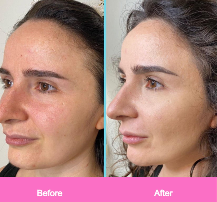 Fine Face Sculptor