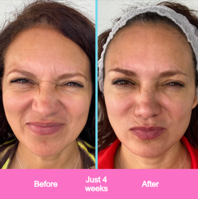 Fine Face Sculptor